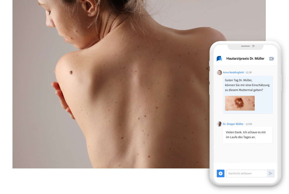 Teledermatologie